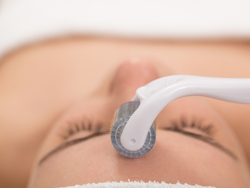 Microneedling Dermaroller