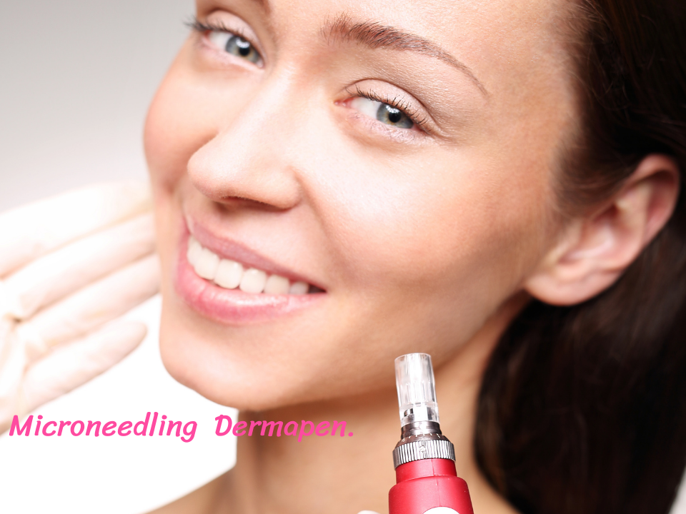 Microneedling